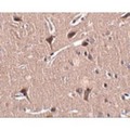 ZNF667 / MIPU1 Antibody - Immunohistochemistry of MIPU1 in human brain tissue with MIPU1 antibody at 2.5 µg/mL.