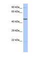ZNF669 Antibody - ZNF669 antibody Western blot of THP-1 cell lysate. This image was taken for the unconjugated form of this product. Other forms have not been tested.