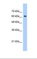 ZNF675 Antibody - Jurkat cell lysate. Antibody concentration: 1.25 ug/ml. Gel concentration: 12%.  This image was taken for the unconjugated form of this product. Other forms have not been tested.