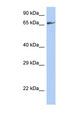 ZNF676 Antibody - ZNF676 antibody Western blot of Jurkat lysate. This image was taken for the unconjugated form of this product. Other forms have not been tested.