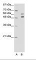ZNF682 Antibody - A: Marker, B: Jurkat Cell Lysate.  This image was taken for the unconjugated form of this product. Other forms have not been tested.
