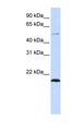 ZNF683 Antibody - ZNF683 antibody Western blot of 721_B cell lysate. This image was taken for the unconjugated form of this product. Other forms have not been tested.