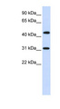 ZNF684 Antibody - ZNF684 antibody Western blot of Fetal Brain lysate. This image was taken for the unconjugated form of this product. Other forms have not been tested.