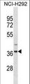 ZNF696 Antibody - ZNF696 Antibody western blot of NCI-H292 cell line lysates (35 ug/lane). The ZNF696 antibody detected the ZNF696 protein (arrow).