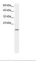 ZNF7 Antibody - Jurkat Cell Lysate.  This image was taken for the unconjugated form of this product. Other forms have not been tested.
