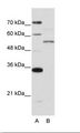 ZNF707 Antibody - A: Marker, B: Jurkat Cell Lysate.  This image was taken for the unconjugated form of this product. Other forms have not been tested.