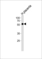 ZNF71 Antibody - ZNF71 Antibody western blot of human placenta tissue lysates (35 ug/lane). The ZNF71 antibody detected the ZNF71 protein (arrow).
