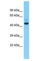 ZNF735 Antibody - ZNF735 antibody Western Blot of Uterus Tumor. Antibody dilution: 1 ug/ml.  This image was taken for the unconjugated form of this product. Other forms have not been tested.