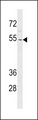 ZNF736 Antibody - ZNF736 Antibody western blot of K562 cell line lysates (35 ug/lane). The ZNF736 antibody detected the ZNF736 protein (arrow).