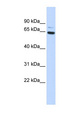 ZNF74 Antibody - ZNF74 antibody Western blot of 293T cell lysate. This image was taken for the unconjugated form of this product. Other forms have not been tested.