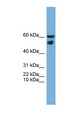 ZNF765 Antibody - ZNF765 antibody Western blot of HCT15 cell lysate. This image was taken for the unconjugated form of this product. Other forms have not been tested.