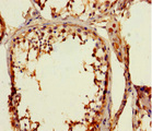 ZNF77 Antibody - Immunohistochemistry of paraffin-embedded human testis tissue using ZNF77 Antibody at dilution of 1:100