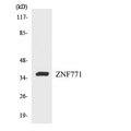 ZNF771 Antibody - Western blot analysis of the lysates from HUVECcells using ZNF771 antibody.