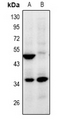 ZNF771 Antibody - Western blot analysis of ZNF771 expression in HepG2 (A), HEK293T (B) whole cell lysates.