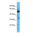 ZNF772 Antibody - Western blot of Human Thymus Tumor. ZNF772 antibody dilution 1.0 ug/ml.  This image was taken for the unconjugated form of this product. Other forms have not been tested.