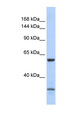 ZNF777 Antibody - ZNF777 antibody Western blot of 721_B cell lysate. This image was taken for the unconjugated form of this product. Other forms have not been tested.