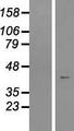 ZNF781 Protein - Western validation with an anti-DDK antibody * L: Control HEK293 lysate R: Over-expression lysate