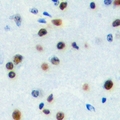 ZNF785 Antibody - Immunohistochemical analysis of ZNF785 staining in human brain formalin fixed paraffin embedded tissue section. The section was pre-treated using heat mediated antigen retrieval with sodium citrate buffer (pH 6.0). The section was then incubated with the antibody at room temperature and detected with HRP and DAB as chromogen. The section was then counterstained with hematoxylin and mounted with DPX.