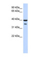 ZNF785 Antibody - ZNF785 antibody Western blot of Fetal Pancreas lysate. This image was taken for the unconjugated form of this product. Other forms have not been tested.