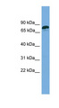 ZNF790 Antibody - ZNF790 antibody Western blot of 721_B cell lysate. This image was taken for the unconjugated form of this product. Other forms have not been tested.