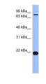 ZNF800 Antibody - ZNF800 antibody Western blot of Fetal Small Intestine lysate. This image was taken for the unconjugated form of this product. Other forms have not been tested.