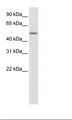 ZNF823 Antibody - Fetal Liver Lysate.  This image was taken for the unconjugated form of this product. Other forms have not been tested.