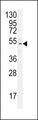 ZNF829 Antibody - ZNF829 Antibody western blot of MCF-7 cell line lysates (35 ug/lane). The ZNF829 antibody detected the ZNF829 protein (arrow).