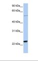 ZNF83 / HPF1 Antibody - Jurkat cell lysate. Antibody concentration: 1.0 ug/ml. Gel concentration: 12%.  This image was taken for the unconjugated form of this product. Other forms have not been tested.