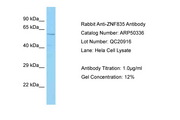 ZNF835 Antibody -  This image was taken for the unconjugated form of this product. Other forms have not been tested.