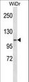 ZNF836 Antibody - ZNF836 Antibody western blot of WiDr cell line lysates (35 ug/lane). The ZNF836 antibody detected the ZNF836 protein (arrow).