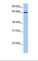 ZNF837 Antibody - Jurkat cell lysate. Antibody concentration: 1.0 ug/ml. Gel concentration: 12%.  This image was taken for the unconjugated form of this product. Other forms have not been tested.