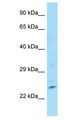ZNF846 Antibody - ZNF846 antibody Western Blot of Fetal Small Intestine. Antibody dilution: 1 ug/ml.  This image was taken for the unconjugated form of this product. Other forms have not been tested.