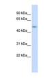 ZNF851 / ZBTB44 Antibody - ZBTB44 / BTBD15 antibody Western blot of HeLa lysate. This image was taken for the unconjugated form of this product. Other forms have not been tested.