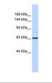 ZNF91 Antibody - Fetal muscle lysate. Antibody concentration: 1.0 ug/ml. Gel concentration: 6-18%.  This image was taken for the unconjugated form of this product. Other forms have not been tested.