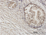 ZNF92 Antibody - Immunoperoxidase of monoclonal antibody to ZNF92 on formalin-fixed paraffin-embedded human prostate. [antibody concentration 1.2 ug/ml]