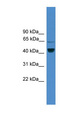 ZRANB2 / ZNF265 Antibody - ZRANB2 antibody Western blot of COLO205 cell lysate. This image was taken for the unconjugated form of this product. Other forms have not been tested.