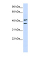 ZRANB2 / ZNF265 Antibody - ZRANB2 antibody Western blot of Fetal Muscle lysate. This image was taken for the unconjugated form of this product. Other forms have not been tested.