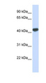 ZRANB2 / ZNF265 Antibody - ZRANB2 antibody Western blot of MCF7 cell lysate. This image was taken for the unconjugated form of this product. Other forms have not been tested.