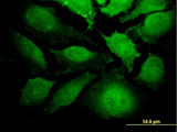 ZRP-1 / TRIP6 Antibody - Immunofluorescence of monoclonal antibody to TRIP6 on HeLa cell. [antibody concentration 35 ug/ml]