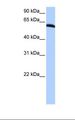 ZRP-1 / TRIP6 Antibody - HepG2 cell lysate. Antibody concentration: 0.5 ug/ml. Gel concentration: 12%.  This image was taken for the unconjugated form of this product. Other forms have not been tested.