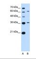 ZSCAN12 Antibody - Lane A: Marker. Lane B: Jurkat cell lysate. Antibody concentration: 5.0 ug/ml. Gel concentration: 12%.  This image was taken for the unconjugated form of this product. Other forms have not been tested.