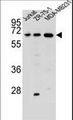ZSCAN2 Antibody - ZSCAN2 Antibody western blot of Jurkat,ZR-75-1,MDA-MB231 cell line lysates (35 ug/lane). The ZSCAN2 antibody detected the ZSCAN2 protein (arrow).