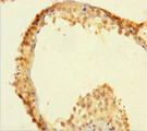 ZSCAN20 Antibody - Immunohistochemistry of paraffin-embedded human testis tissue using ZSCAN20 Antibody at dilution of 1:100