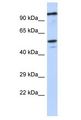 ZSCAN5 / ZSCAN5A Antibody - ZSCAN5 / ZSCAN5A antibody Western Blot of SH-SYSY. Antibody dilution: 1 ug/ml.  This image was taken for the unconjugated form of this product. Other forms have not been tested.