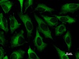 ZW10 Antibody - Immunostaining analysis in HeLa cells. HeLa cells were fixed with 4% paraformaldehyde and permeabilized with 0.1% Triton X-100 in PBS. The cells were immunostained with anti-ZW10 mAb.