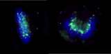 ZWINT Antibody - Detection of Human ZWINT-1 by Immunocytochemistry. Sample: Formaldelyde-fixed HeLa cells. Antibody: Affinity purified rabbit anti-ZWINT-1 used at a dilution of 1:200 (1 ug/ml). Detection: Green fluorescent goat anti-rabbit IgG highly cross-adsorbed Antibody FITC conjugated used at a dilution of 1:100 (right).