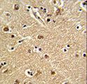 ZWINT Antibody - Formalin-fixed and paraffin-embedded human brain tissue reacted with ZWINT Antibody , which was peroxidase-conjugated to the secondary antibody, followed by DAB staining. This data demonstrates the use of this antibody for immunohistochemistry; clinical relevance has not been evaluated.