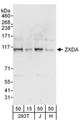 ZXDA Antibody - Detection of Human ZXDA by Western Blot. Samples: Whole cell lysate from 293T(15 and 50 ug), Jurkat (J; 50 ug) and HeLa (H; 50 ug) cells. Antibodies: Affinity purified rabbit anti-ZXDA antibody used for WB at 0.4 ug/ml. Detection: Chemiluminescence with an exposure time of 3 minutes.