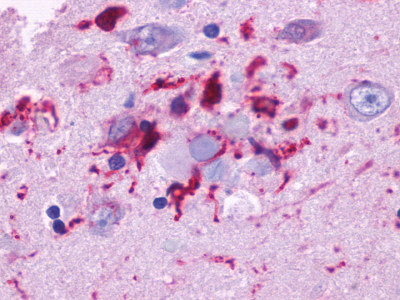 Amyloid core stained with antibody LS-A1193 to GPR39.