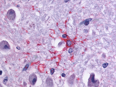 Brain, Alzheimer's protoplasmic astrocyte